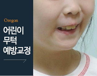 어린이무턱예방교정